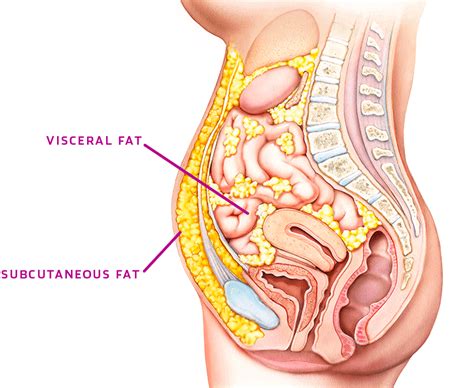 Visceral Fat vs. Subcutaneous Fat — What's the Difference? - Peter Attia