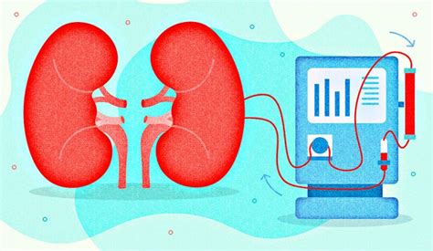 Kidney Dialysis: Types, Cost, Doctors, Hospitals & Best Dialysis Center ...