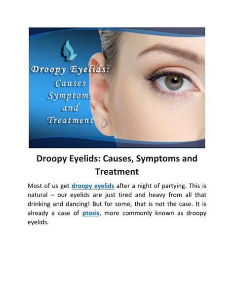 Droopy Eyelids Causes, Symptoms and Treatment