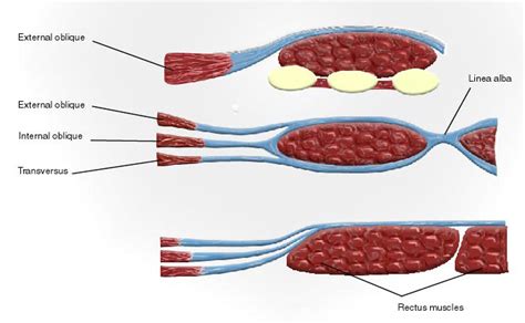 RCSI - Drawing Rectus sheath above and below arcuate line - English ...