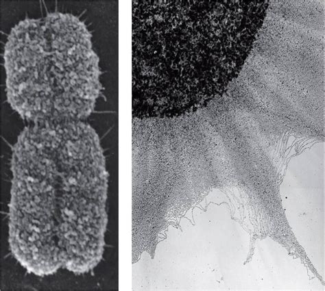 Electron Microscope Images Of Chromosomes