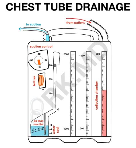 Chest Tube Drainage System