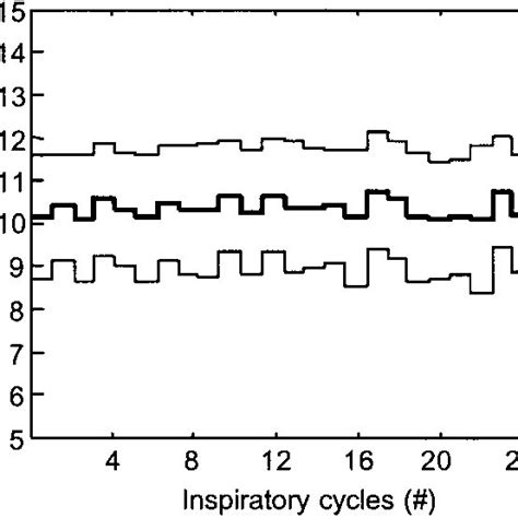 Measurement of static intrinsic positive end-expiratory pressure (PEEP ...