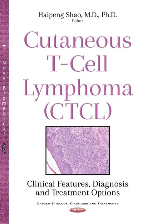 Cutaneous t cell lymphoma treatment