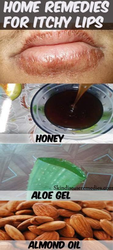 7 Home Remedies for Itchy Lips | Cure for chapped lips, Chapped lips ...