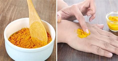 7 Home Remedies for Skin Fungus That Actually Work - Small Joys