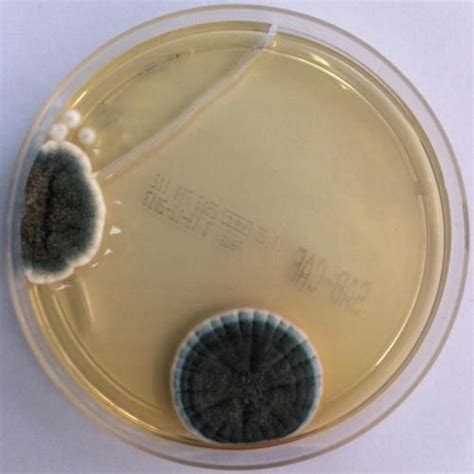 Aspergillus versicolor su Sabouraud Agar Hematology, Microscopy ...