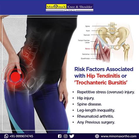 hip pain treatment without surgery - carpentiermaynard