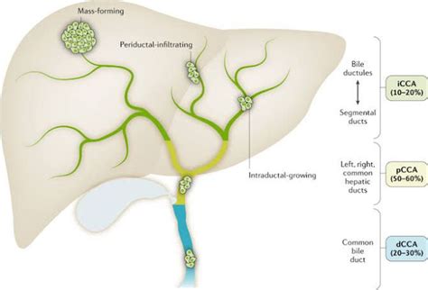 Cholangiocarcinoma symptoms - MEDizzy