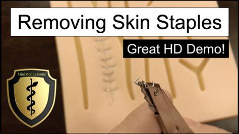 Surgical STAPLE REMOVAL - Best Practices! HD Demonstration - YouTube