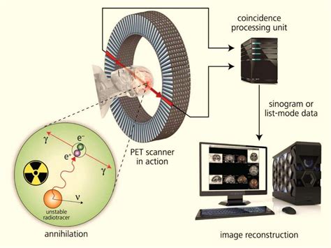 What is a Positron Emission Tomography?