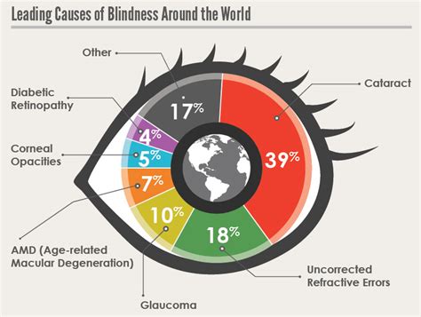 Lack of Access to Eye Care Services Leading to Avoidable Blindness