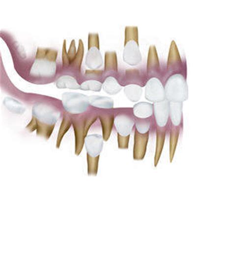 Mixed Dentition | News | Dentagama