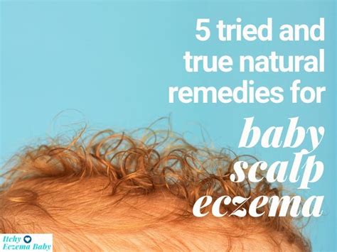 5 Best Home Remedies for Eczema on the Scalp | Itchy Eczema Baby