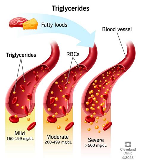 Triglycerides: Levels Normal Range, 40% OFF