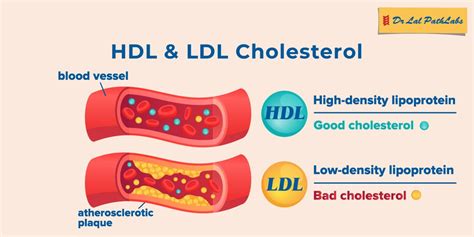 What is HDL Cholesterol and LDL Cholesterol | Dr Lal PathLabs Blogs