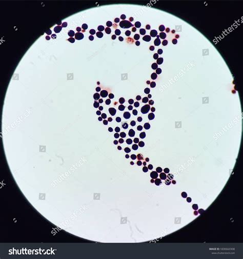 Gram Stain Cryptococcus Diffluens Which Fungi Stock Photo 1830660308 ...