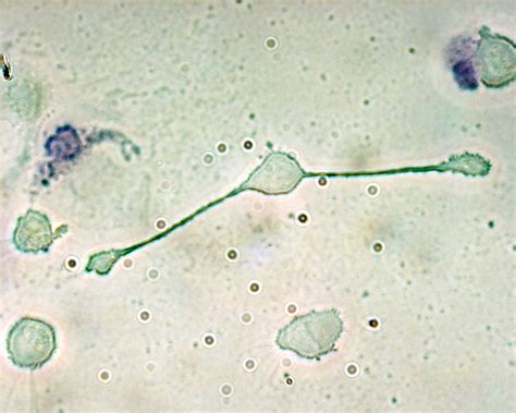 Macrophage - Wikipedia