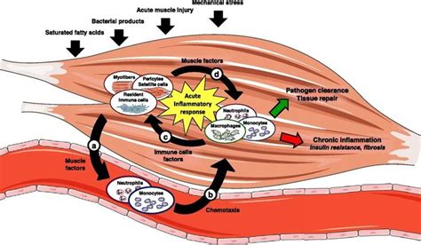 178 best Myositis Education images on Pinterest | Autoimmune disease ...