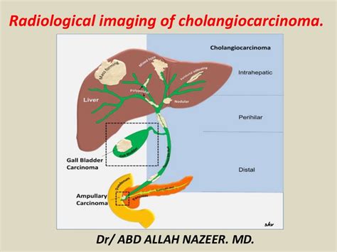 Presentation1.pptx, radiological imaging of cholangiocarcinoma.