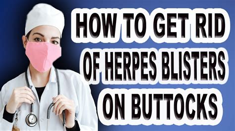 how to get rid of herpes blister on buttocks - YouTube