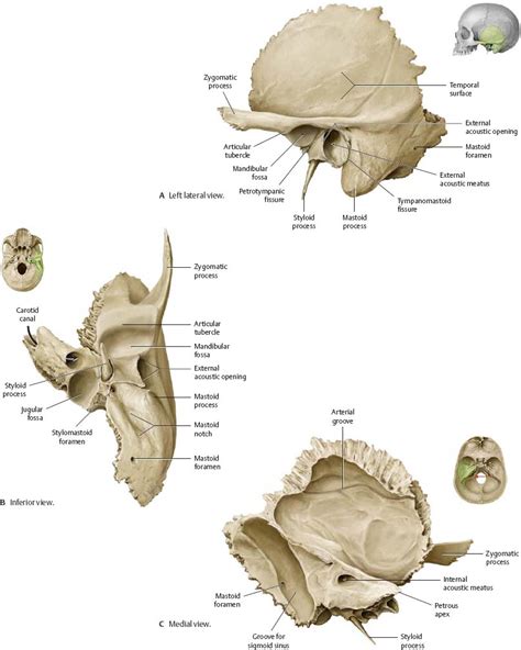 Petrous Temporal Bone