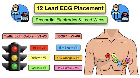 12 Lead ECG Placement: Diagram And Mnemonic For Limb And, 46% OFF