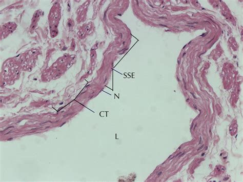 Simple Squamous Epithelium Slide