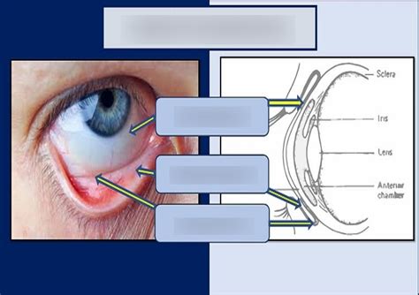 Histology: Conjunctiva Diagram | Quizlet