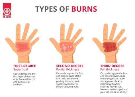 How To Treat Friction Burn – Telegraph