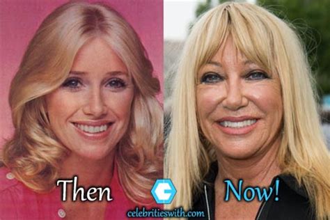 Suzanne Somers Plastic Surgery, Facelift, Boob Job Before After Pics ...