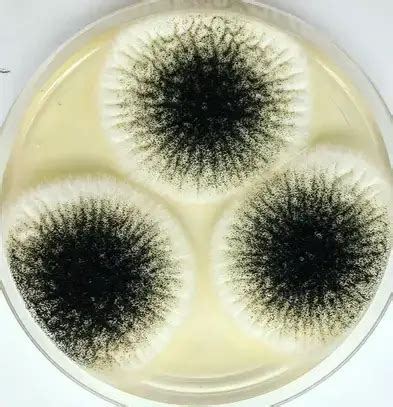 Sabouraud Dextrose Agar (SDA) - Composition, Preparation, Principle ...