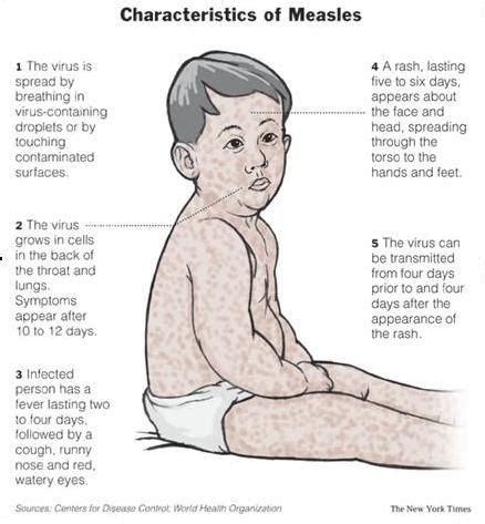 Ellie is talking about...: Measles, Mumps and Rubella