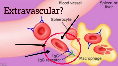 Extravascular Hemolysis Simplified|Medschool simplified - YouTube