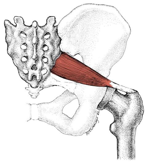 Piriformis Trigger Points