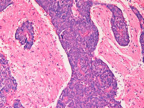 Normal Brain Histology