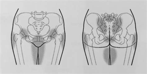 Pregnancy Pelvic Pain - VivehealthVivehealth