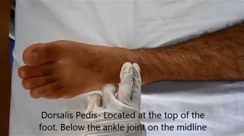 Posterior tibial pulses