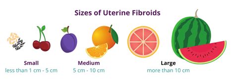 A Visual Guide To Fibroid Sizes | USA Fibroid Centers