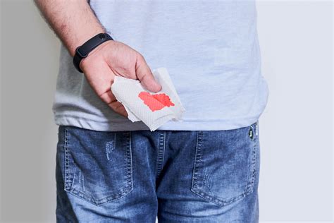 Young male hand holds a piece of toilet paper with blood from ...