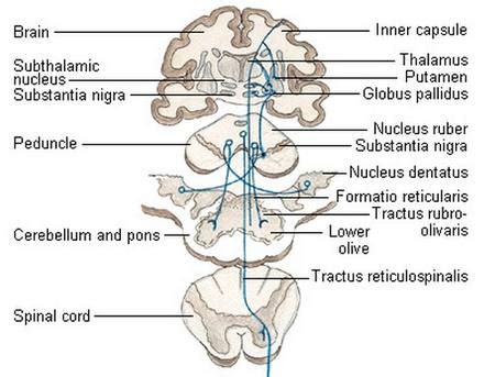 Extrapyramidal Disorder - Symptoms, Side Effects, System, Tract, Signs