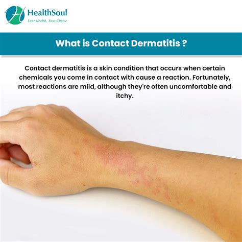 Contact Dermatitis Symptoms Causes And Treatment Options | The Best ...