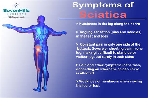 What Is Sciatica What Are The Symptoms Of Sciatica | Images and Photos ...