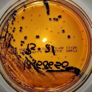 Salmonella Shigella (SS) Agar- Composition, Principle,, 57% OFF