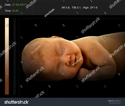 15,046 Baby in womb Images, Stock Photos & Vectors | Shutterstock