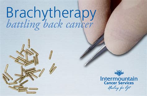 Brachytherapy an alternative to general radiation