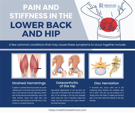 Why Does My Lower Back and Hip Hurt? - NJ's Top Orthopedic Spine & Pain ...