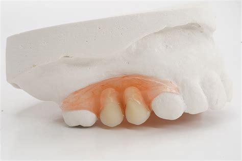 Valplast Partial (Lower)– ROE Dental Laboratory