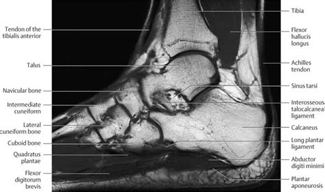 Foot Muscles Mri Anatomy - - Tendinous, ligamentous, and muscle ...