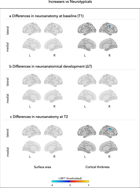 Neuroanatomical differences between neurotypicals and those individuals ...